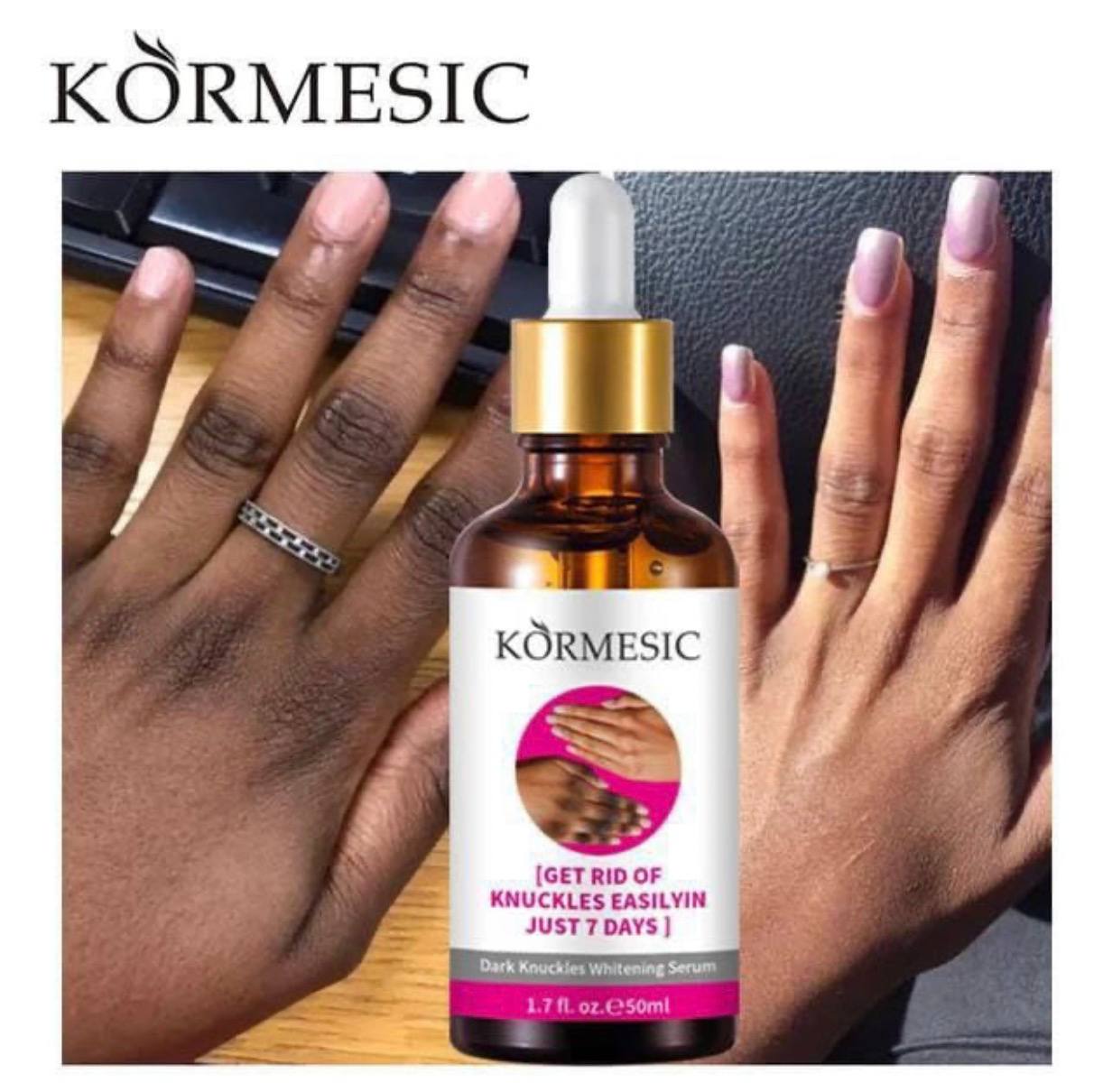 Sérum KORMESIC: Dites adieu aux Taches Rebelles, kinto, genoux, coudes noirs (2 ACHETE=1 OFFERT Traitement complet)🇨🇲