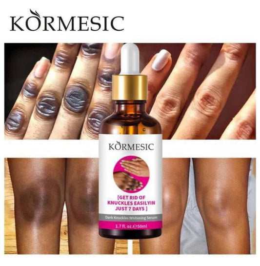Sérum KORMESIC: Dites adieu aux Taches Rebelles, kinto, genoux, coudes noirs (2 ACHETE=1 OFFERT Traitement complet)🇨🇲