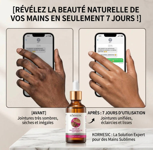 Dites adieu aux Taches Rebelles, kinto, genoux, coudes noirs